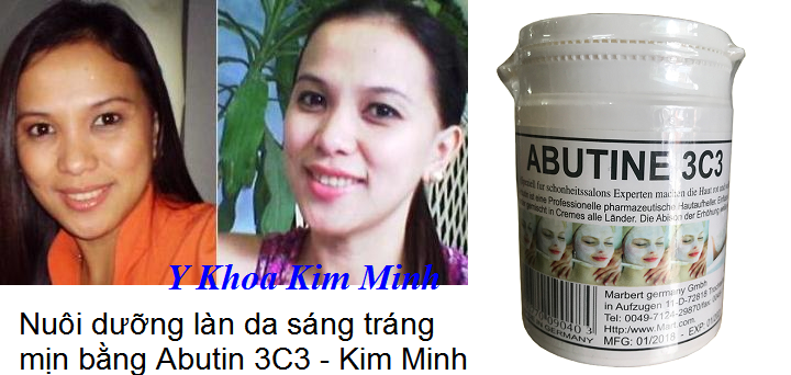 Nuôi dưỡng làn dáng tráng trắng mịn bằng Abutin 3C3 - Y khoa Kim Minh 0933455388