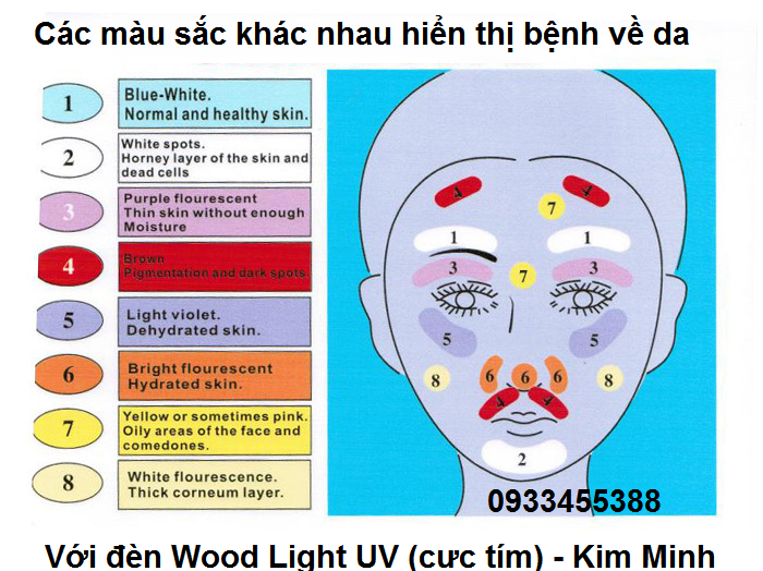 Ban kiểm tra màu sắc của da cho phép bạn tìm hiểu về bệnh da Wood Light Wood Lamp UV Kim Minh