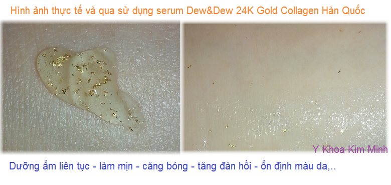 Dew&Dew 24K Gold Collagen serum Korea bán tại Y Khoa Kim Minh 0933455388