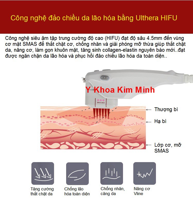 Cong nghe may HIFU Ultherap SMAS V-258 - Y Khoa Kim Minh