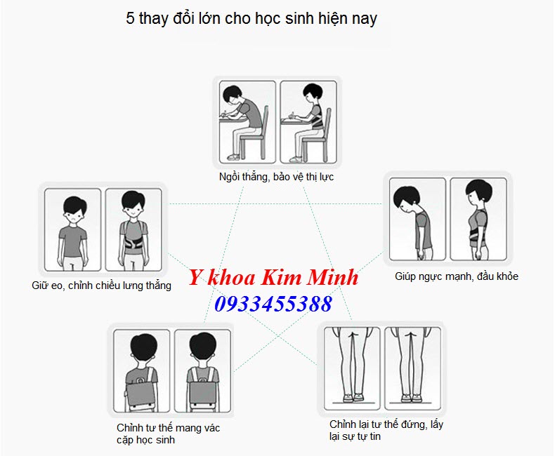 Dai nep chinh cot song, dai chinh veo cot song cua hoc sinh - Y khoa Kim Minh