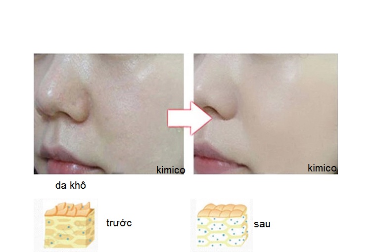 Den sinh hoc cham soc da bioled KSC177 Y Khoa Kim Minh