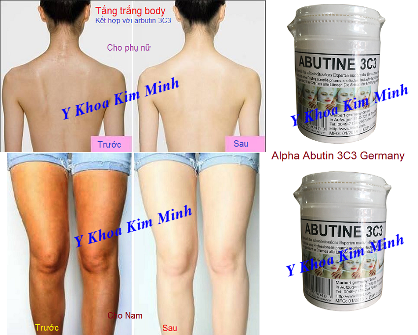 HDSD bột Abutin 3C3 Germany dùng tắm trắng body cho nam và nữ - Y Khoa Kim Minh 0933455388