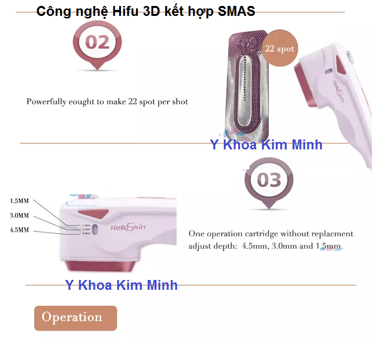 Cong nghe Hifu 3D SMAS HelloSkin mini Hifu Kim Minh