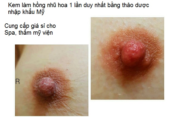 Cung cap ban gia si kem lam hong nhu hoa vung kin bang thao duoc nhap khau My Khoa Kim Minh