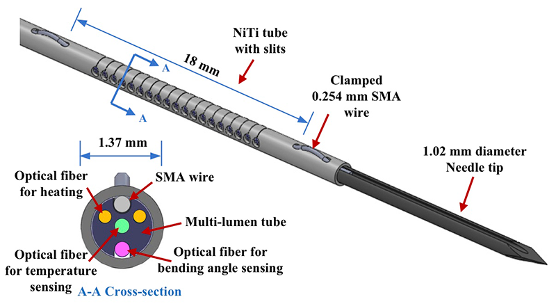 Kim luồng quang dẫn laser điều trị nội mạch Y Khoa Kim Minh