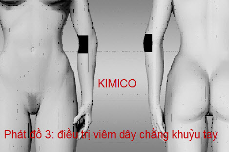 Điều trị chứng đau cổ tay do chơi tennis bằng máy trị liệu trung tần Đông Á J18A2 Y KHoa Kim Minh