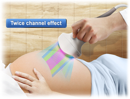 Máy siêu âm y tế màu Sonoace R3 Medison