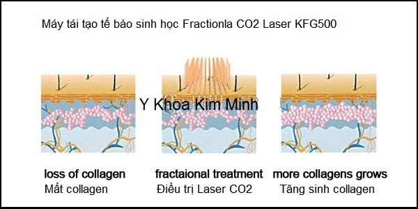 May tai tao te bao da sinh hoc Fractional Laser CO2 KFG500 Y Khoa Kim Minh
