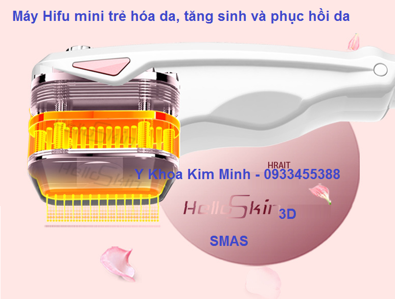 Cong nghe tre hoa da bang Hifu 3D SMAS HelloSkin ban tai tp hochiminh Kim Minh 0933455388