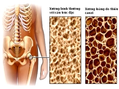 Máy đo chỉ số loãng xương cơ thể KG01