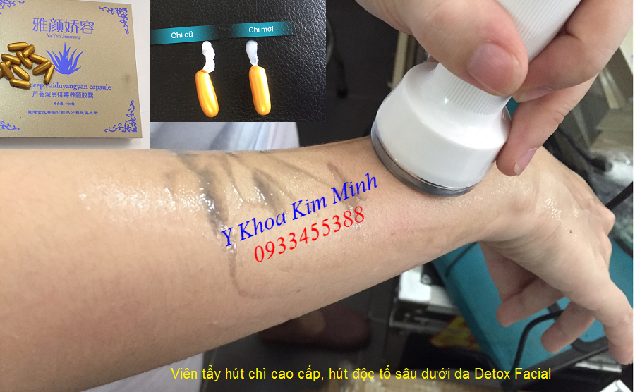 Nơi bán viên hút tẩy chì da mặt chất lượng cao Detox Facial tại Tp Hồ Chí Minh - Y khoa Kim Minh 0933455388