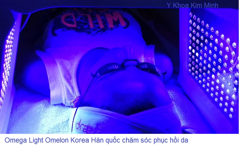 Omega Light Omelon Korea PDT den anh sang sinh hoc cham soc phuc hoi da Y Khoa Kim Minh Tp Hochiminh