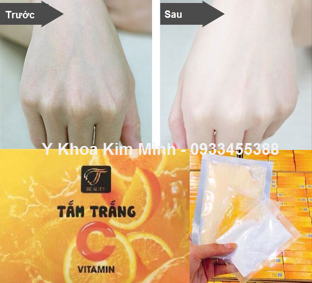 Tam trang cam, tam trang thao moc vitamin C - Y khoa Kim Minh