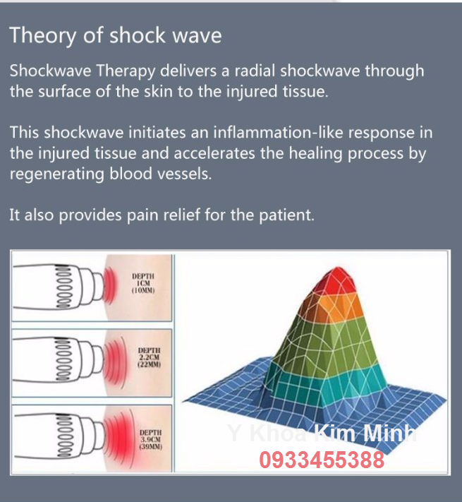 Tính năng điều trị bệnh của máy phát sóng xung kích Shock Wave Therapy - Y Khoa Kim Minh