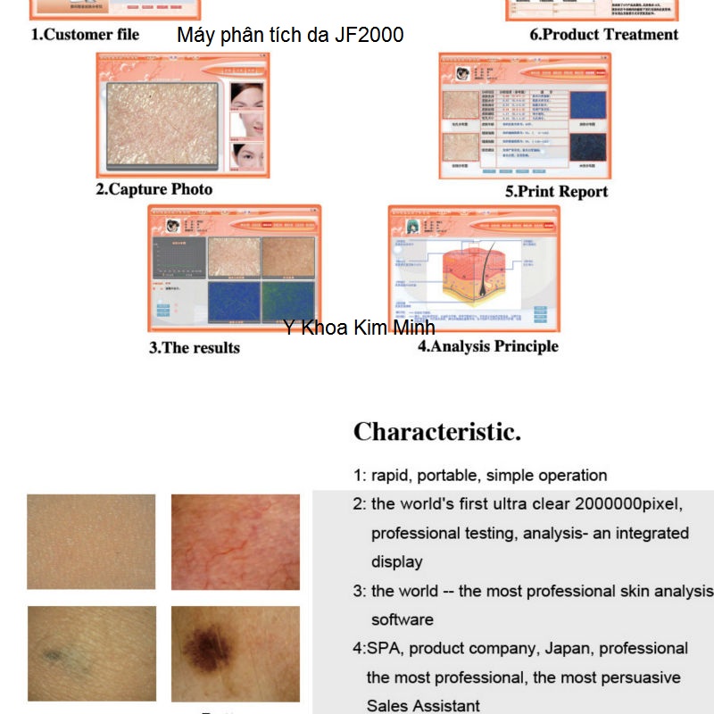 Máy kiểm tra da mặt phân tích bằng phần mềm JF2000 Y Khoa Kim Minh