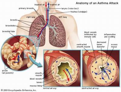 Đo phế dung phổi là gì khi sử dụng máy đo chức năng hô hấp