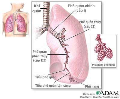 Dấu hiệu và triệu chứng của viêm phổi