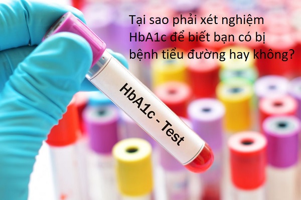 HbA1c là gì? Tại sao phải xét nghiệm HbA1c của người bệnh tiểu đường