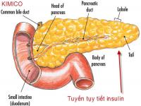 Bệnh tiểu đường là gì, nguyên nhân phát bệnh Bệnh tiểu đường là gì, nguyên nhân phát bệnh