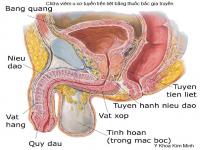 Bán thuốc chữa bệnh viêm u xơ tuyến tiền liệt ở đâu Bán thuốc chữa bệnh viêm u xơ tuyến tiền liệt ở đâu