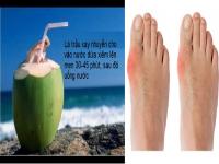 Chữa nhanh bệnh gút bằng lá trầu, nước dừa Chữa nhanh bệnh gút bằng lá trầu, nước dừa