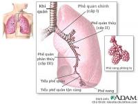 Dấu hiệu và triệu chứng của viêm phổi Dấu hiệu và triệu chứng của viêm phổi
