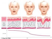 Collagen giảm 1% mỗi năm từ tuổi 20 Collagen giảm 1% mỗi năm từ tuổi 20