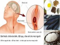 Bài thuốc chữa tai biến đột quỵ chữa tại nhà Bài thuốc chữa tai biến đột quỵ chữa tại nhà