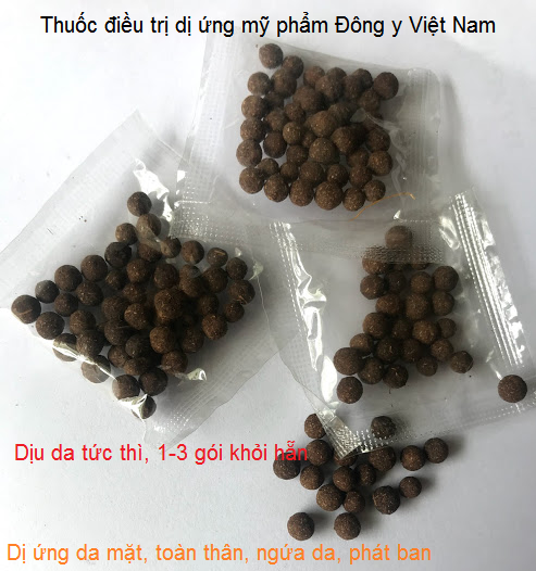 Thuốc điều trị dị ứng da Đông y Việt Nam