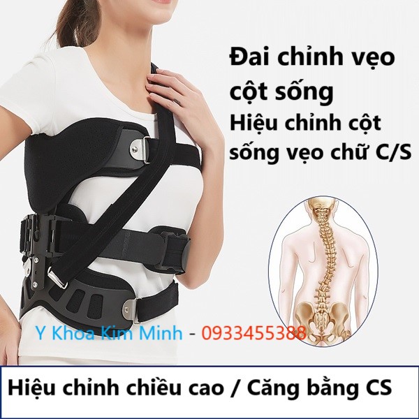 Đai chỉnh vẹo cột sống KX-012