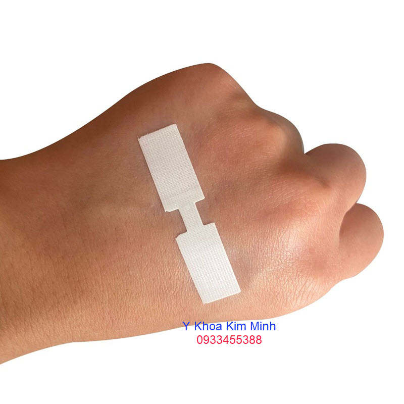 Bandage không khâu chỉ y tế phẫu thuật