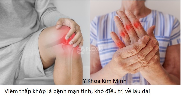 Bệnh đau nhức đa khớp