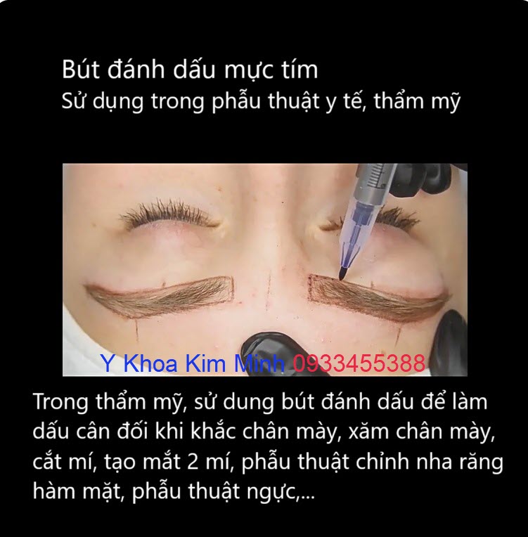 Bút đánh dấu phẫu thuật mực tím dùng để vẽ nét chân mày trước khi xăm chân mày, điêu khắc chân mày, nhấn mí, chỉnh nha răng hàm mặt, phẫu thuật ngực tạo hình thẩm mỹ