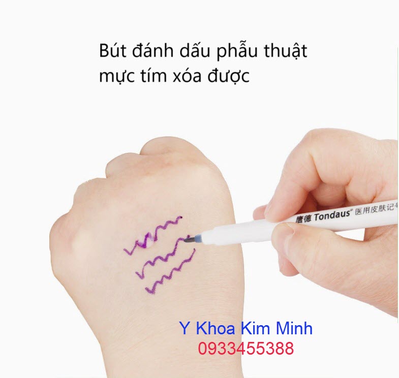 Bút đánh dấu trên da mực tím xóa được