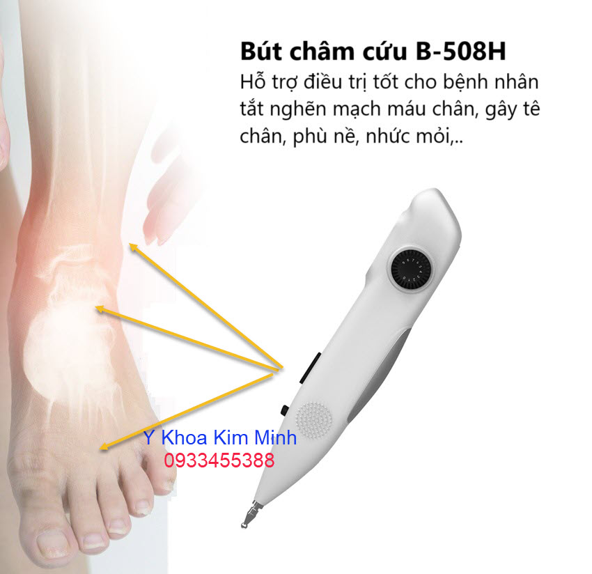 Bút châm cứu xung điện B-508 điều trị tê chân, đau khớp, bệnh thần kinh tọa, đau cổ vai gáy, tê tay hoặc cánh tay hiệu quả