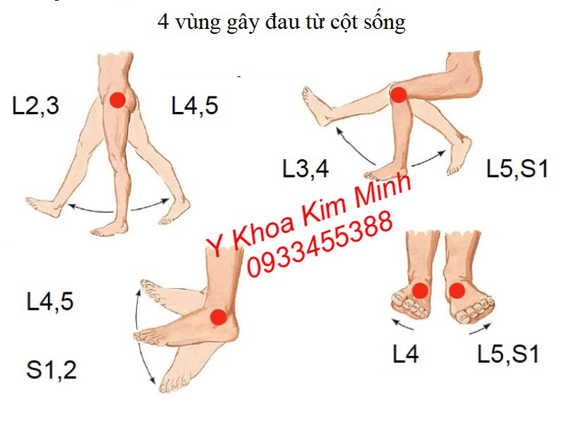 Kiểm tra vùng đau cột sống L3, L4, L5 trước khi dùng tinh dầu quế sơn điều trị tê bại - Y khoa Kim Minh