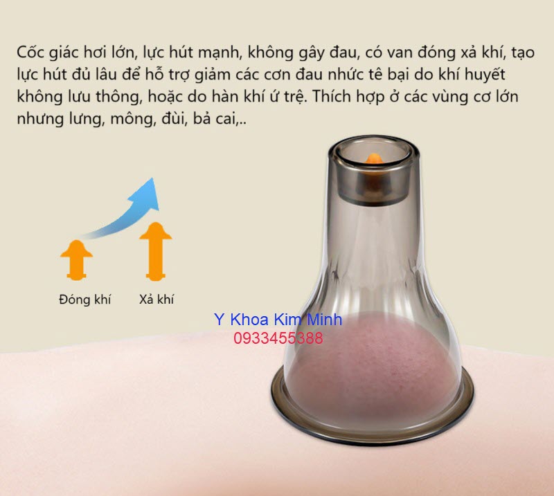 Cốc giác hơi lớn có nhiều ưu điểm như giác hơi mạnh, lực hút dễ điều chỉnh, giải dộc, trục hàn khí nhanh và mạnh hơn thích hợp ở các vùng cơ lớn như lưng mông đùi bả vai canh tay