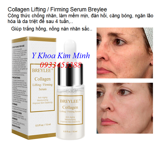 Huyết thanh collagen nuôi dưỡng chống nhăn trẻ hóa da - Y Khoa Kim Minh Collagen Lifting Firming Serum Breylee, huyết thanh chuyên chống nhăn làm mềm mịn, trẻ hóa da - Y khoa Kim Minh
