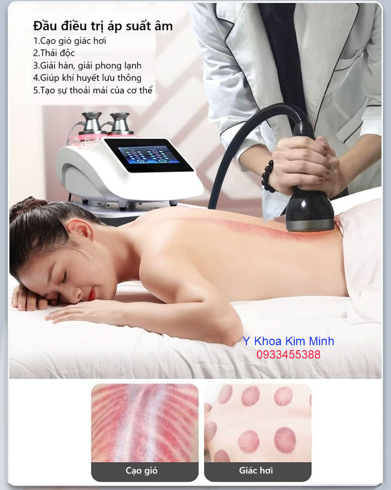 Đầu hút áp suất âm của máy điện di sinh học DDS dùng cạo gió, giác hơi, thải độc, làm mềm cơ lưng, tăng cường sức khỏe