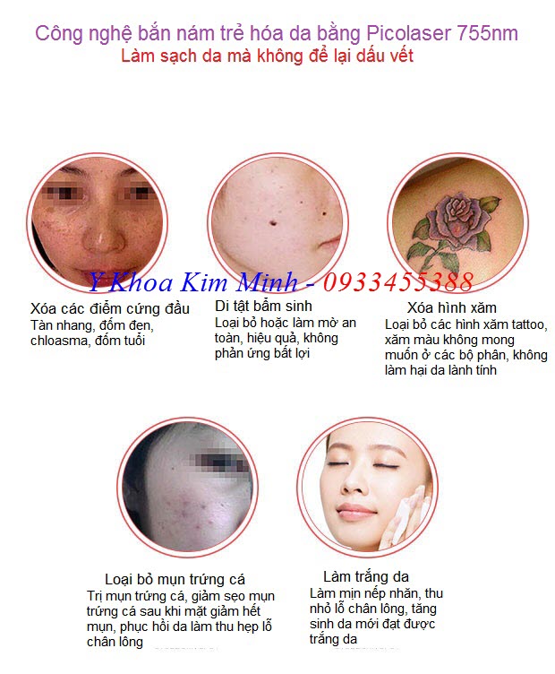 Công dụng chính của máy Picolaser 755nm PL-217 - Y khoa Kim Minh Công dụng của máy Pico laser 755nm PL-217 - Y khoa Kim Minh 0933455388