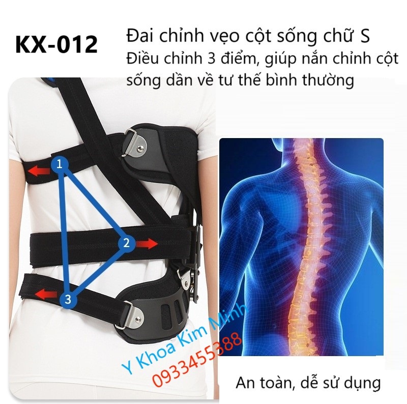 Đai nắn chỉnh cột sống bị vẹo, đai cột sống KX-012 bán ở Tp.HCM