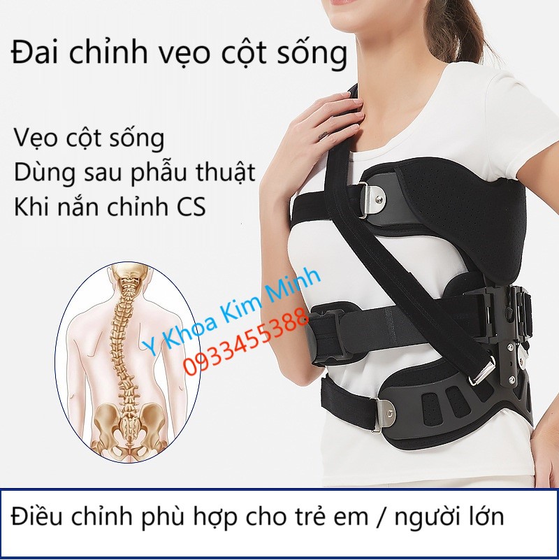 Đai chỉnh vẹo cột sống trẻ em, người lớn KX-012