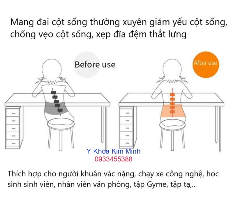 Đai bảo vệ cột sống thắt lưng V-1 có nhiều ưu điểm