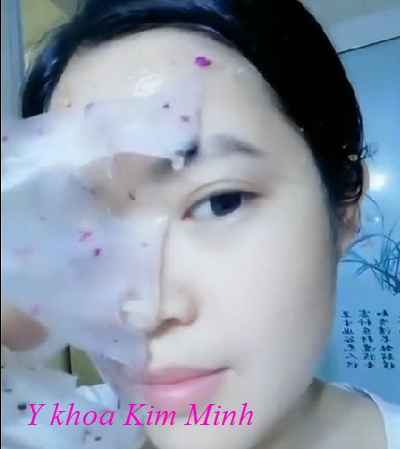 Dap duong trang da bang bot dap mat na collagen hoa hong co canh ban tai Y khoa Kim Minh