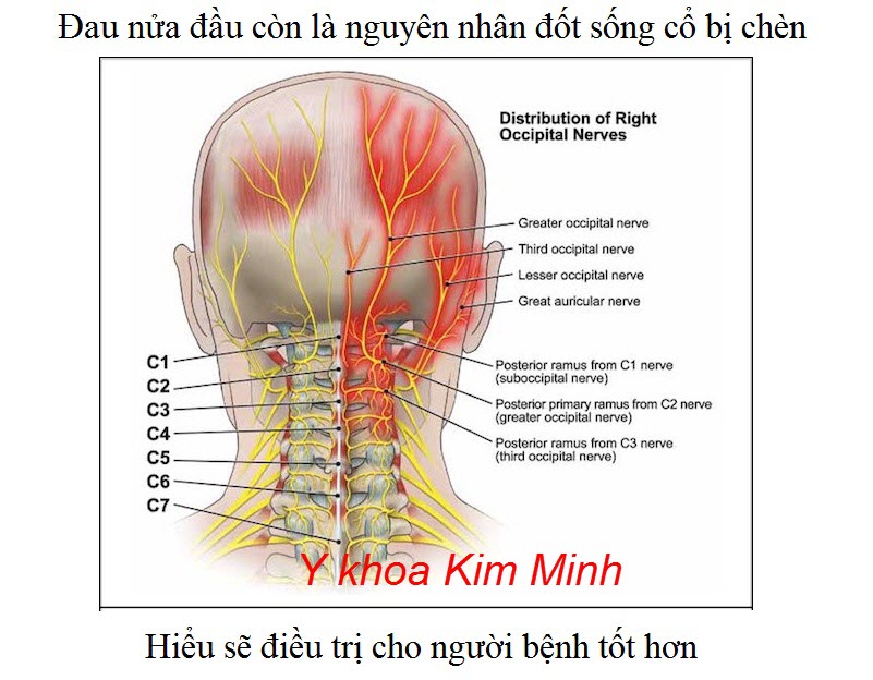 Trị đau đầu, đau nữa đầu bằng tinh dầu quế sơn massage day ấn huyệt đạo C1-C7 - Y khoa Kim Minh