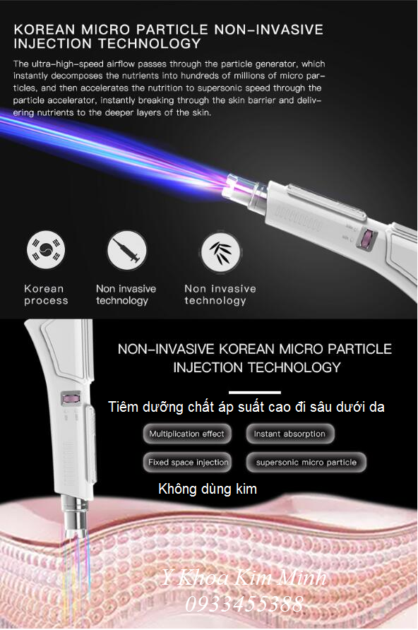 Công nghệ tiêm dưỡng chất áp suất cao - Y khoa Kim Minh Đầu tiêm dưỡng chất áp suất cao dạng nén không cần kim của máy Helloface KM-921 - Y khoa Kim Minh 0933455388