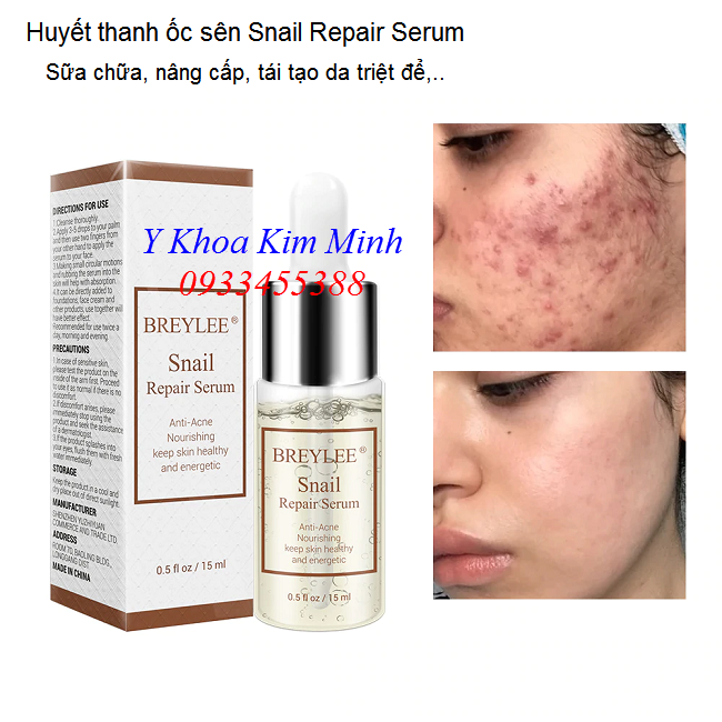 Dịch huyết thanh ốc sên sửa chữa da tổn thương viêm mụn, thô kệch - Y Khoa Kim Minh Dịch huyết thanh ốc sên Snail Repair Serum Breylee sua chua nang cap tai tao da - Y Khoa Kim Minh
