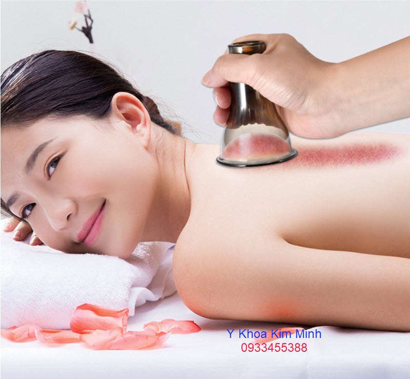 Bộ giác hơi không dùng lửa với cốc giác hơi lớn