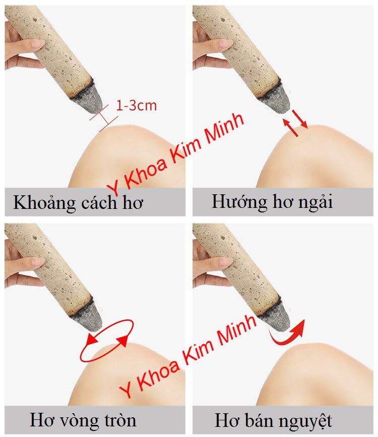 Hướng dẫn sử dụng nhang ngải cứu trị viêm khớp gối - Y Khoa Kim Minh